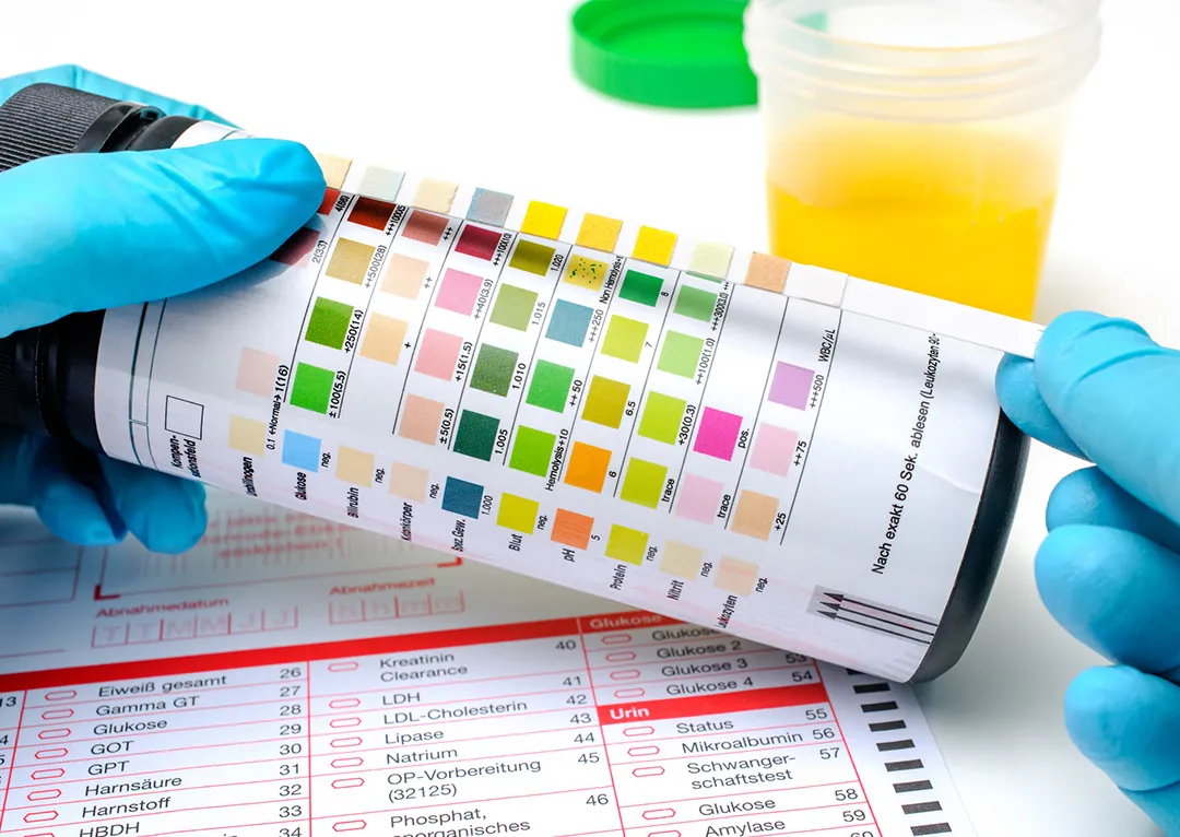 Drug Screening